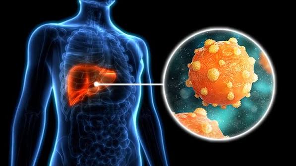 Hepatitis: Perjalanan Melawan Virus yang Menyerang Hati